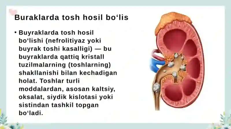 Buyraklarda tosh hosil boʻlishning  oldini olishda kimyoviy asoslari 3