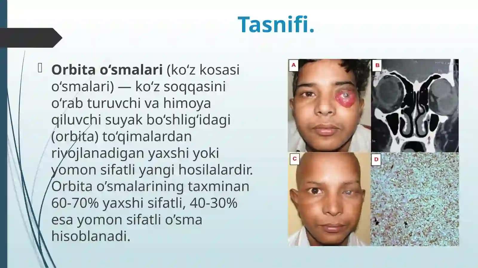 Orbita o'smasi 3