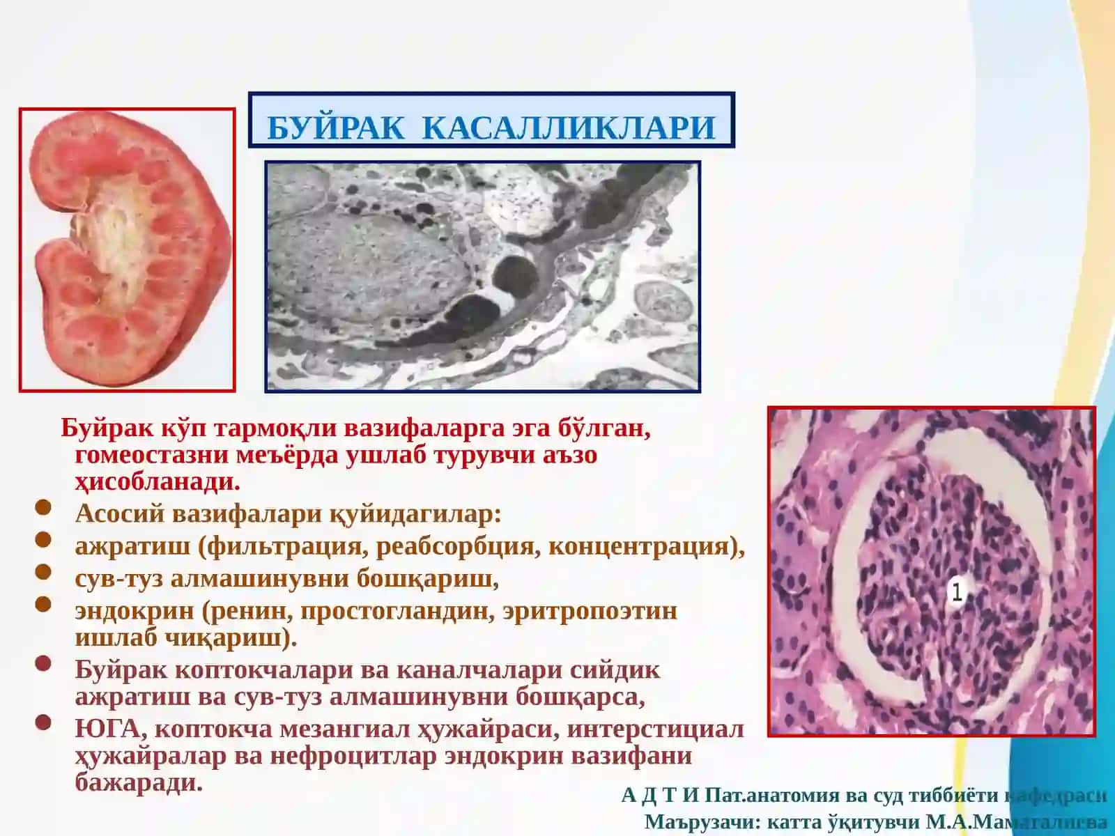 Буйрак касалликлари. Ривожланиш аномалиялари. Гломерулопатиялар. 3