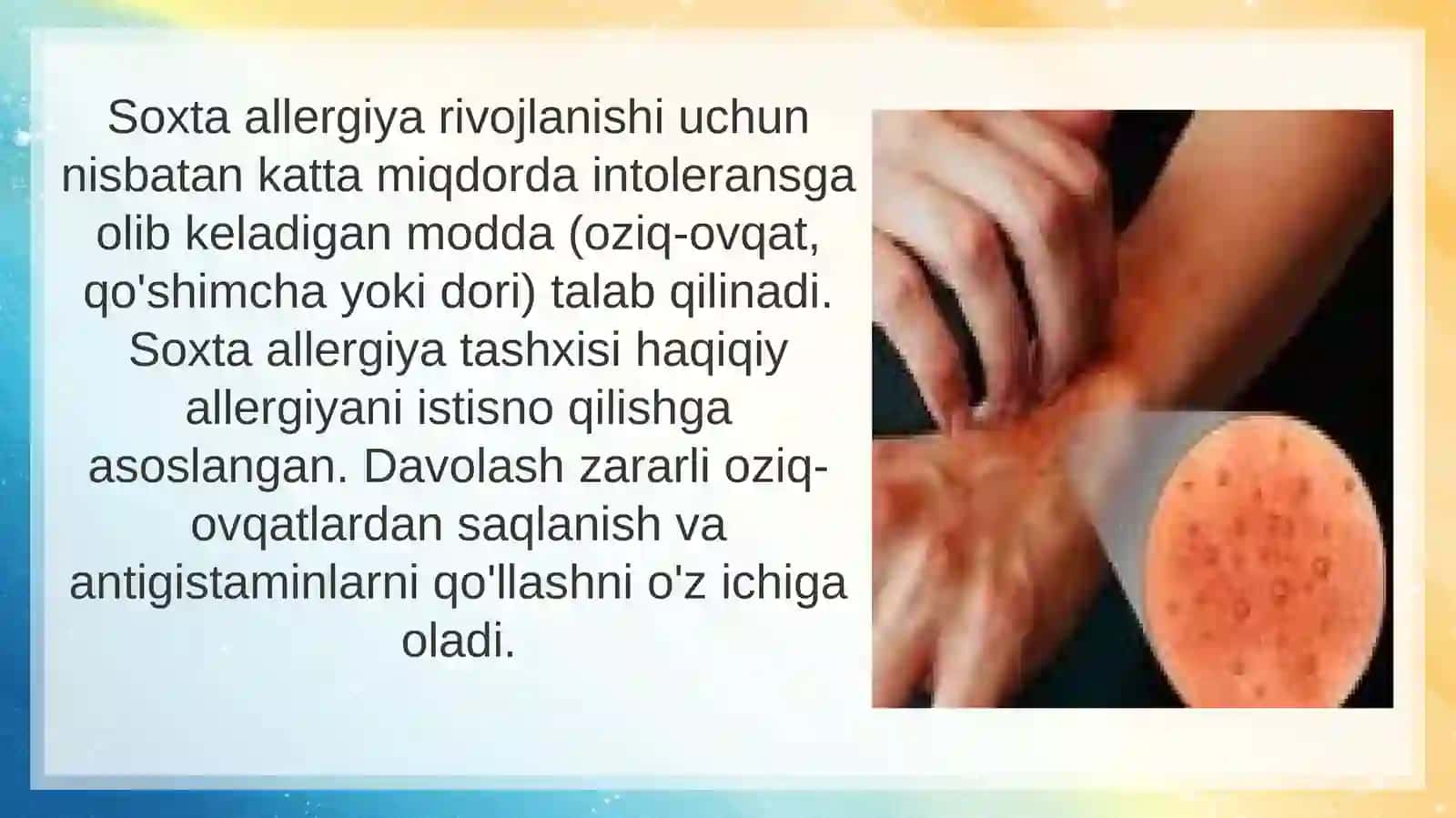 Psevdoallergiya 3