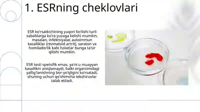 Eritrotsitlarning choʻkish tezligi 3
