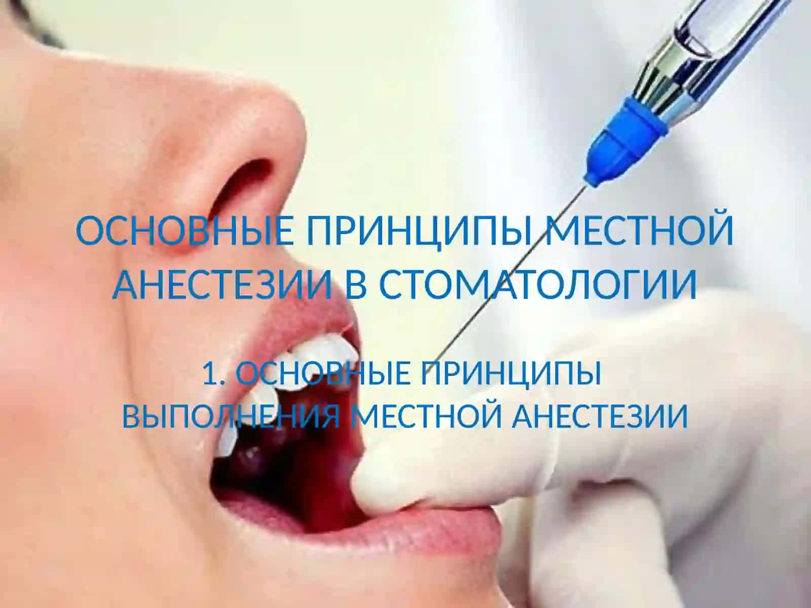 ОСНОВНЫЕ ПРИНЦИПЫ МЕСТНОЙ АНЕСТЕЗИИ В СТОМАТОЛОГИИ 3