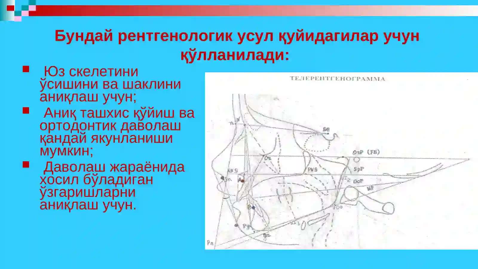 ТЕЛЕРЕНТГЕНОГРАФИЯ 3