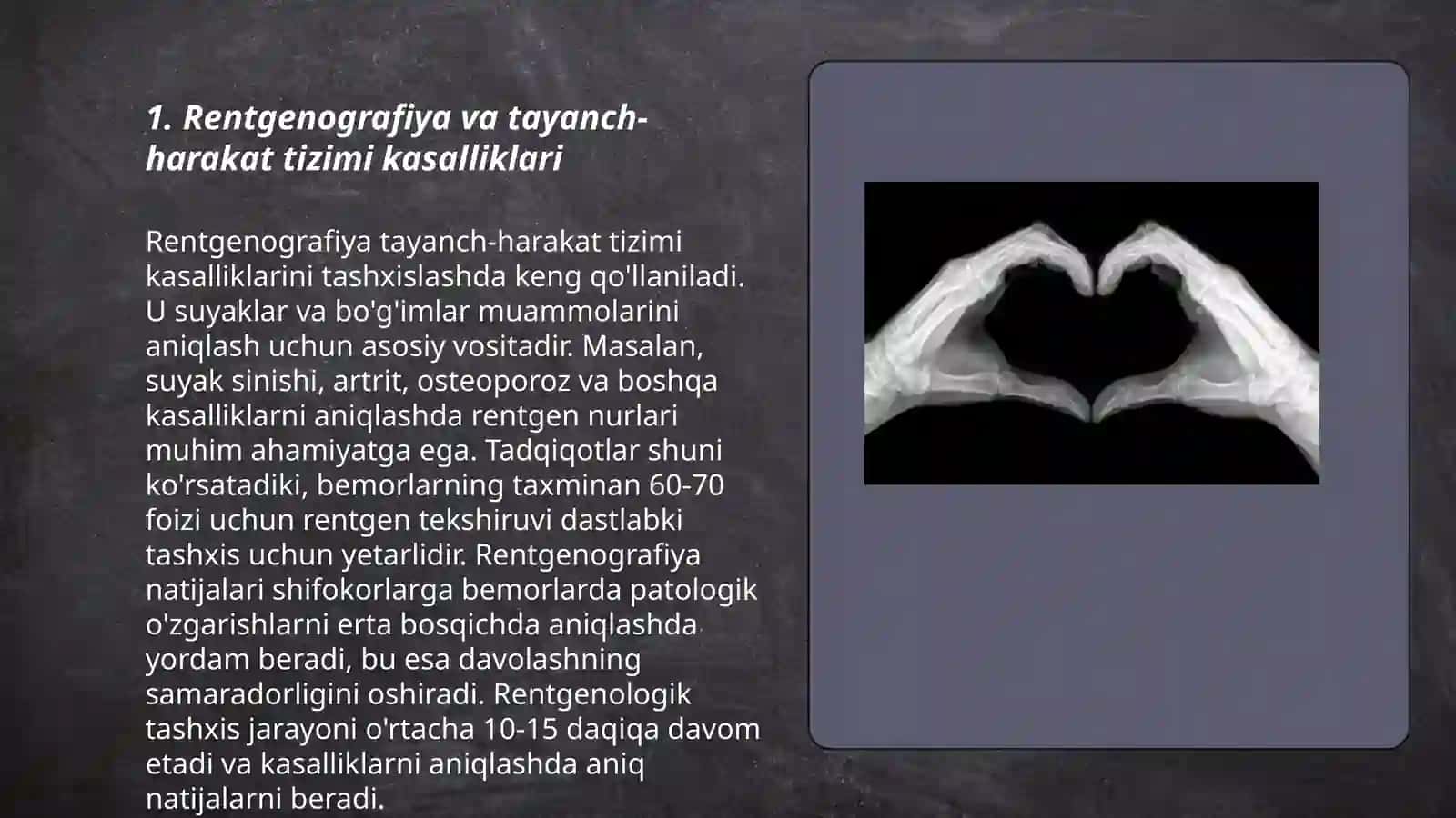 Tayanch-harakat tizimi kasalliklari nur tashxisi 3