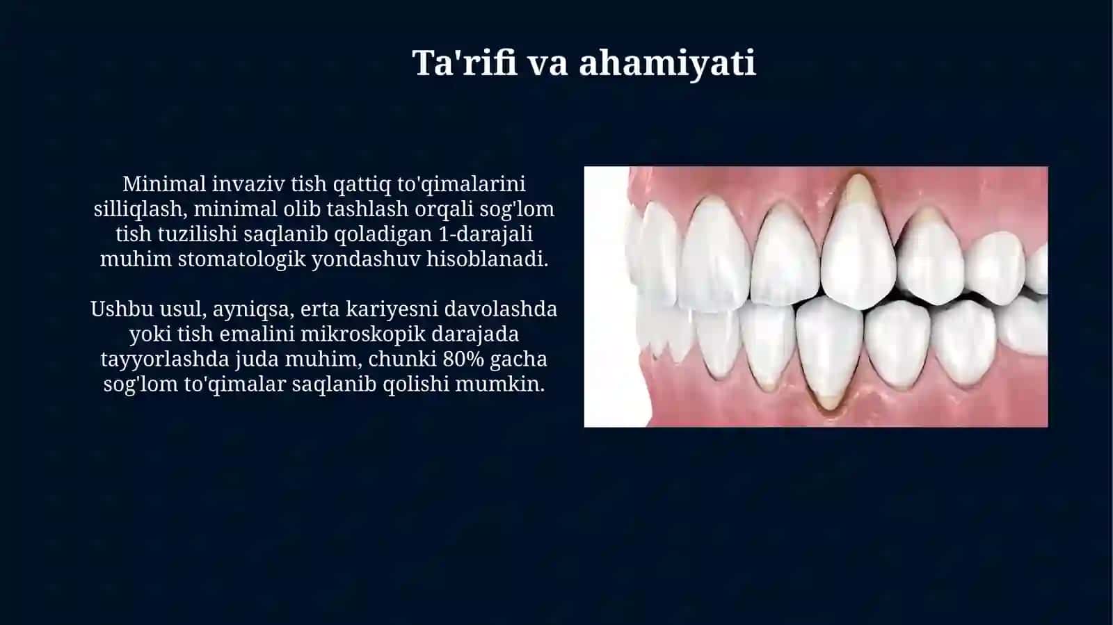 Tish qattiq to'qimasini charxlashning minimal invaziv usullari 3