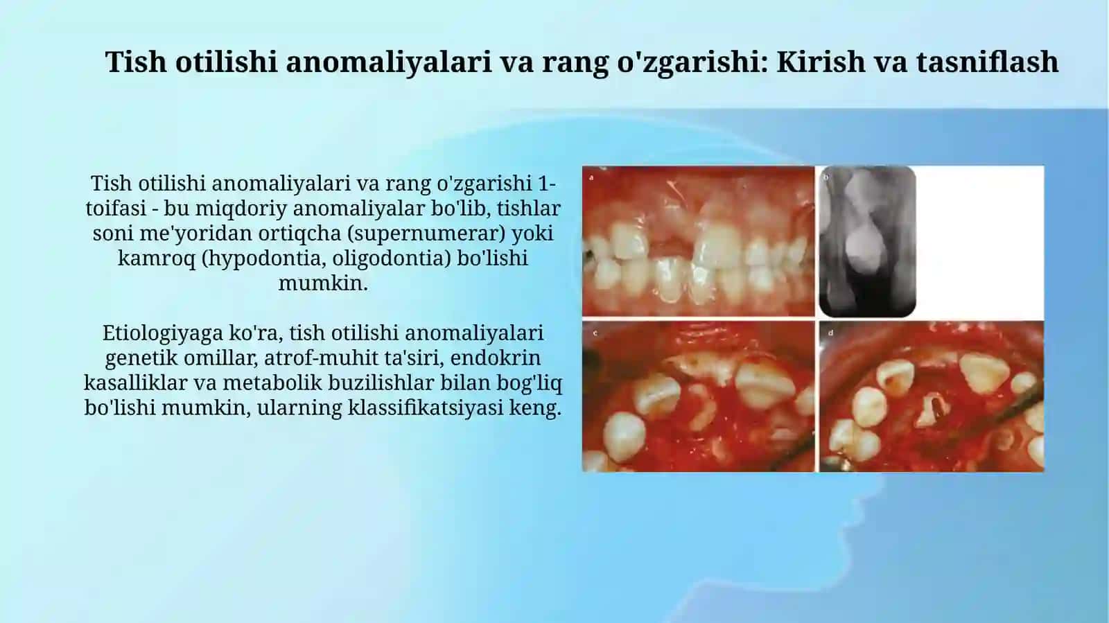 Tish otilishi anomaliyalari va rang o'zgarishi 3