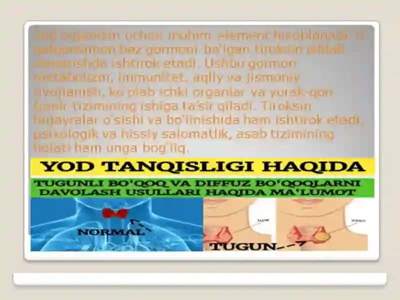 Yod tanqisligi kasalliklari 3