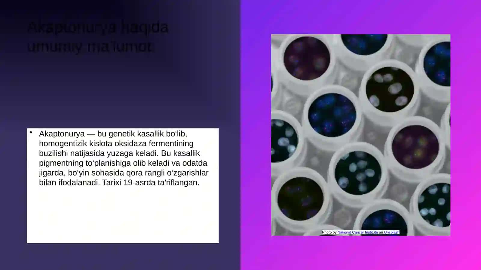 ALKAPTONURIYA 3