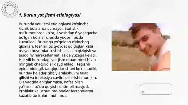 Burun yot jismi etiologiyasi, klinikasi, tashxislash, differensial tashxislash, davolash 3