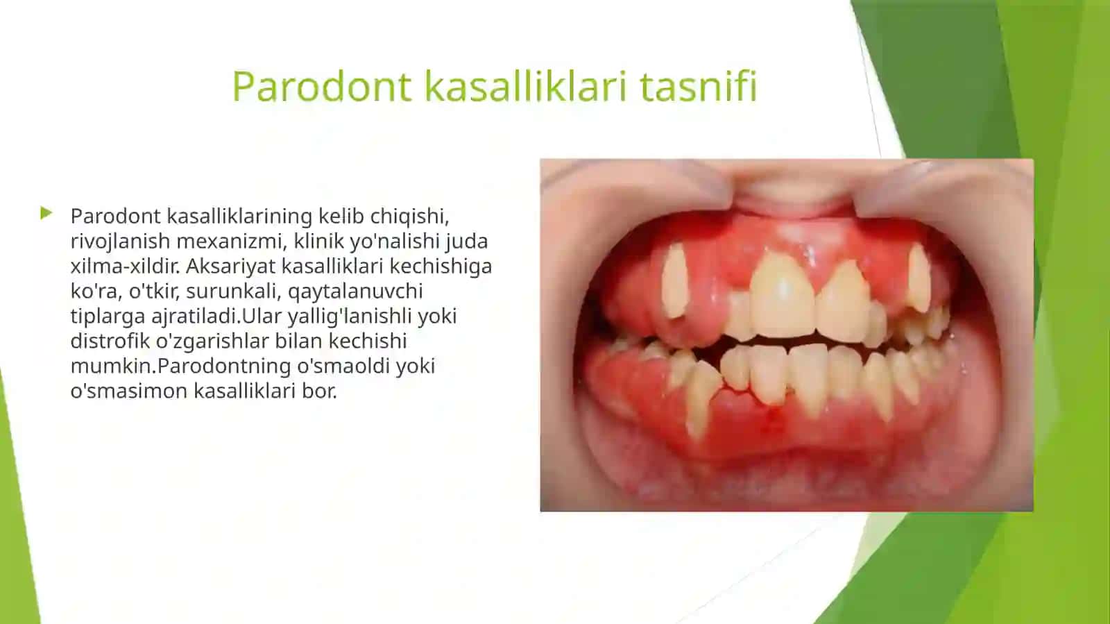 Parodontkasalliklari klinik tekshirish usullari 3