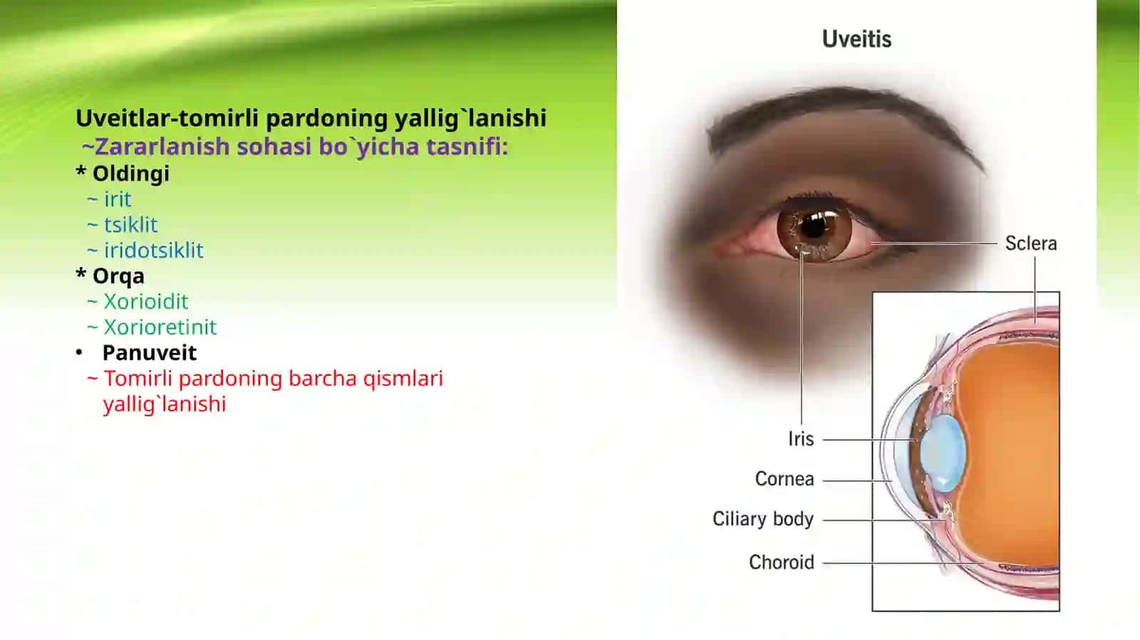 Увеитлар таснифи 3