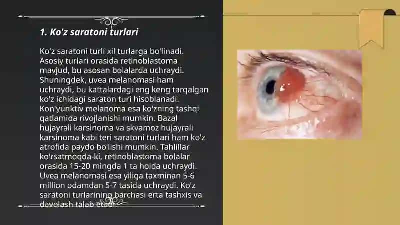 Ko'z Saratoni Haqida 3