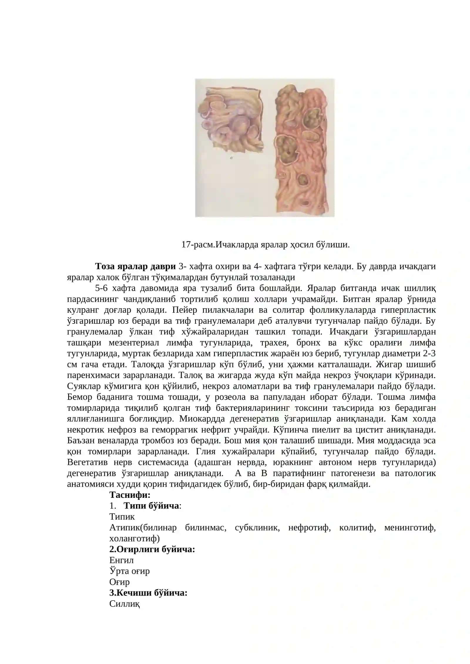 Қорин тифи 3