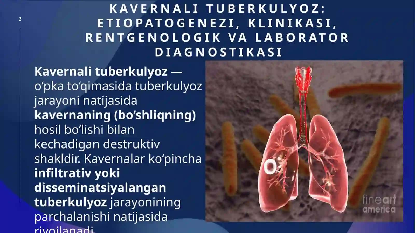 Tuberkulyozning destruktiv shakllari — kavernali va fibroz-kavernali tuberkulyoz 3