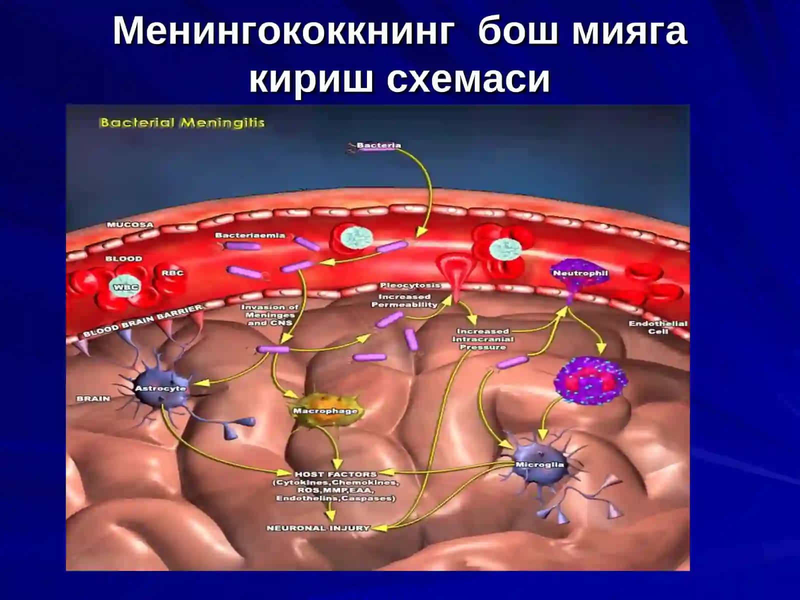 Менингококли инфекция 3