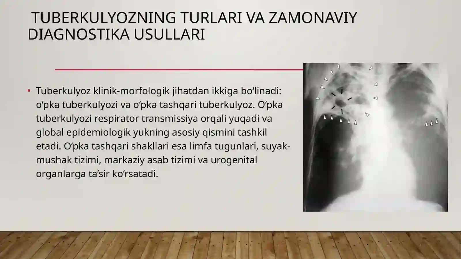 BJSST STANDARTLARI BO`YICHA MDR VA XDR- TB NI DAVOLASH TAMOYILLARI VA USULLLARI 3