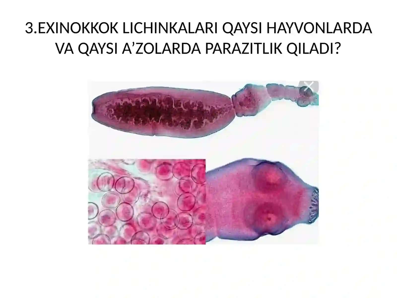PARAZIT CHUVALCHANGLARNI XILMA-XILLIGINI TAKRORLASH 3