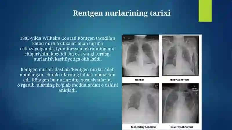 Rentgen nurlari 3