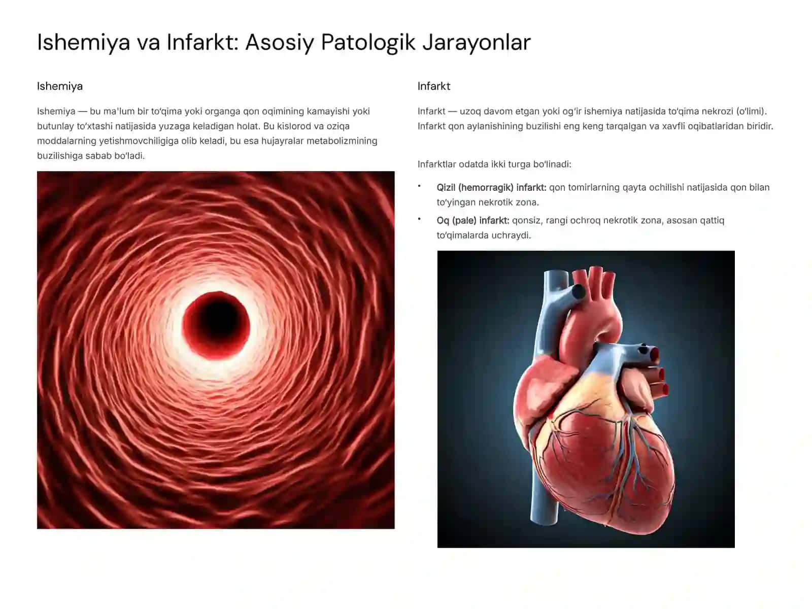 Qon Aylanish Buzilishlarining Patomorfologiyasi 3