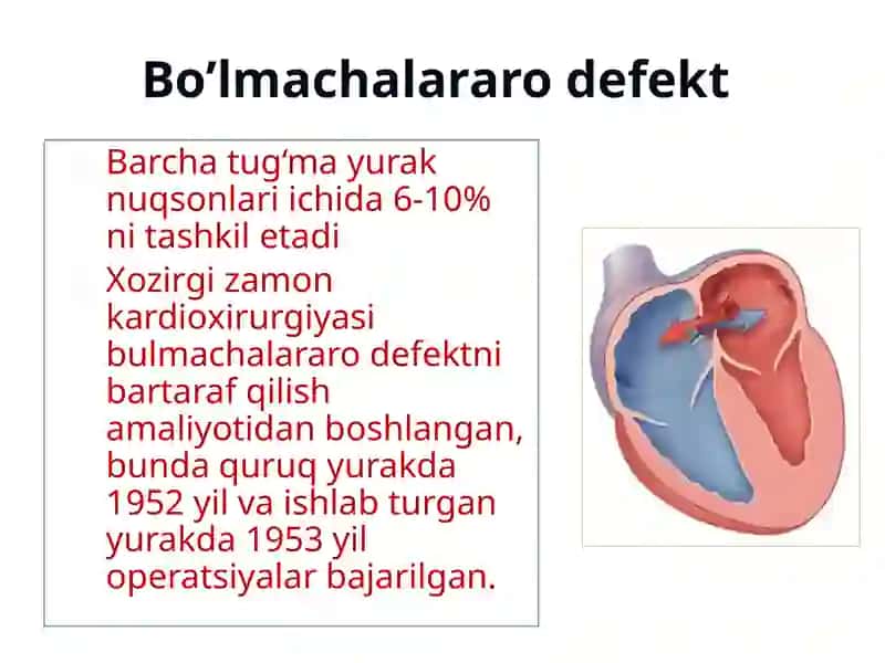 Tug‘mayurak nuqsonlari 3