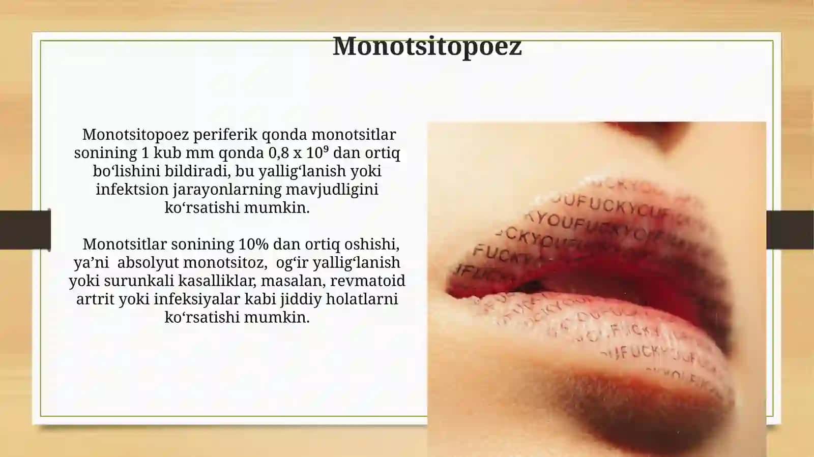 Gomotsitopoez 3