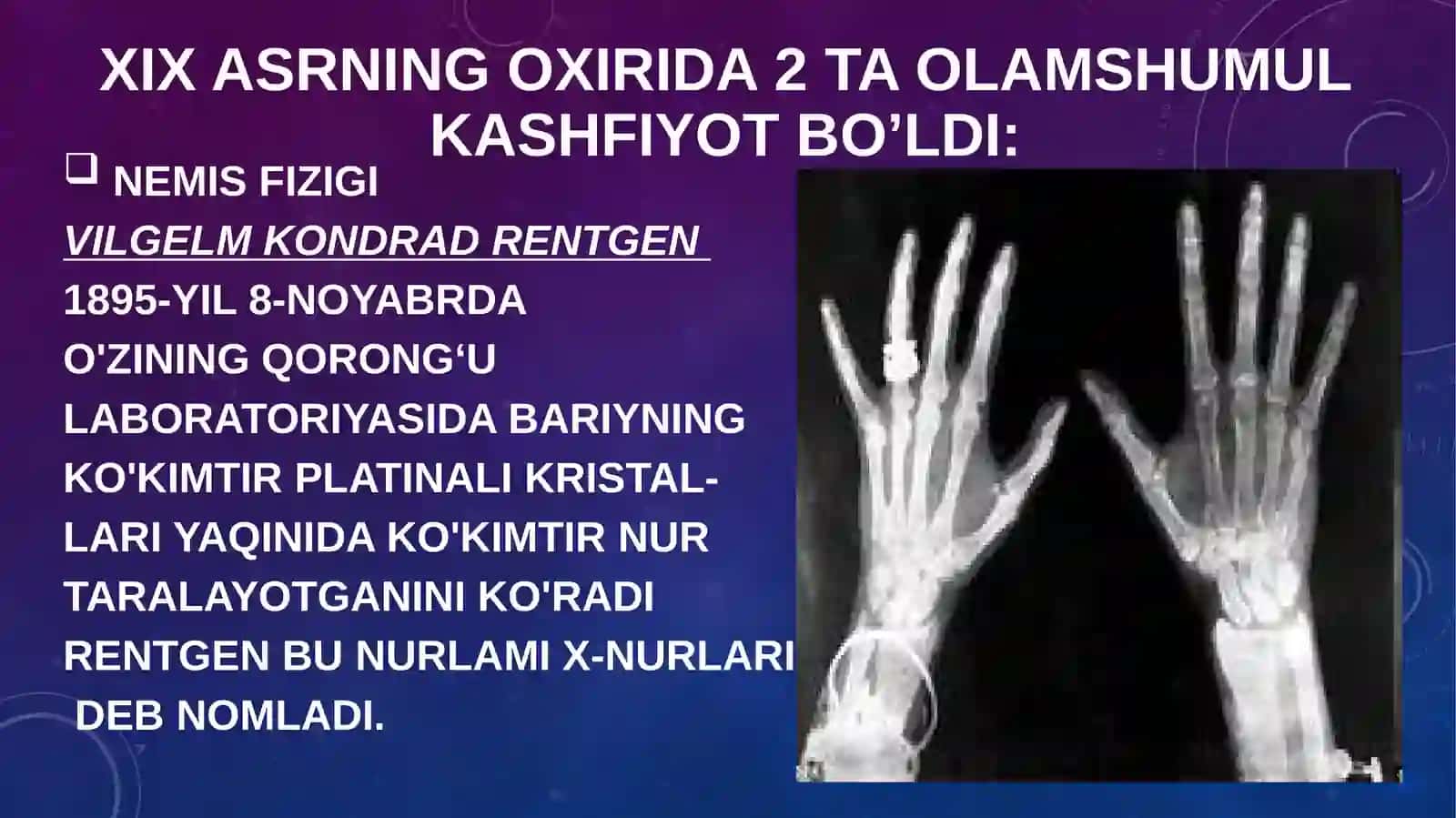 Kasalhonalar rentgen-radiologiya 3