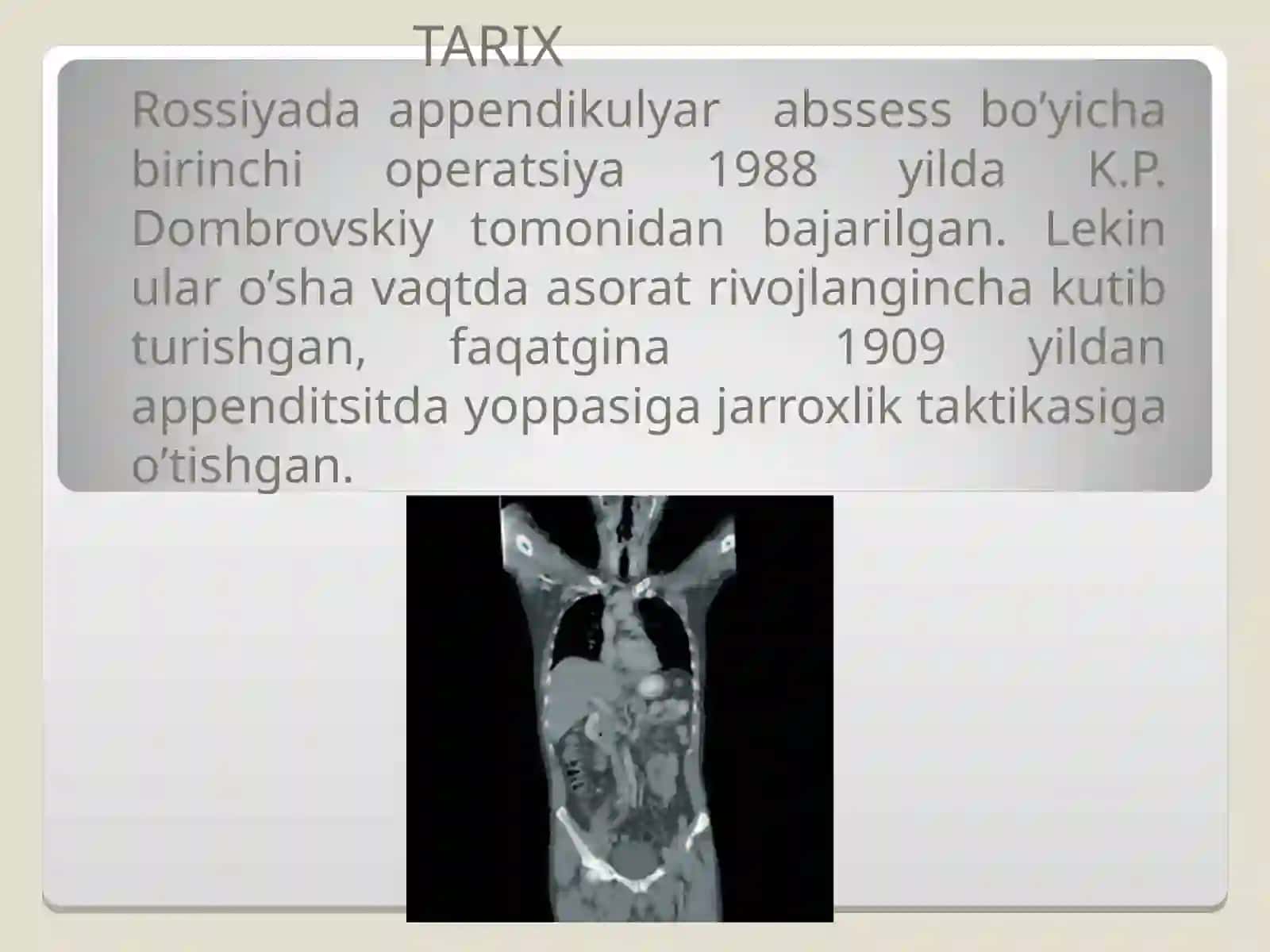 O‘tkir appenditsit asoratlari 3