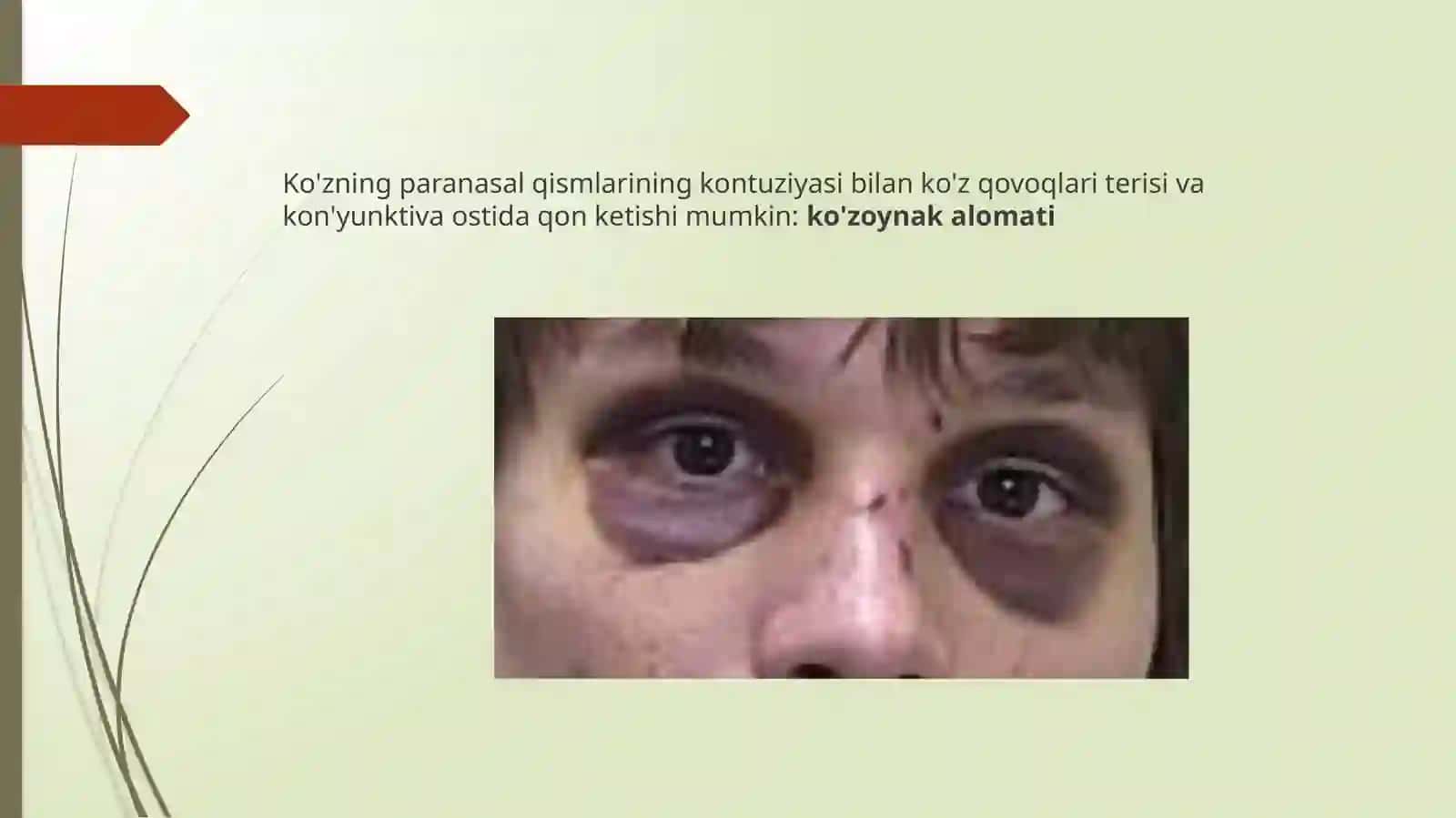 Kontuziyalar 3