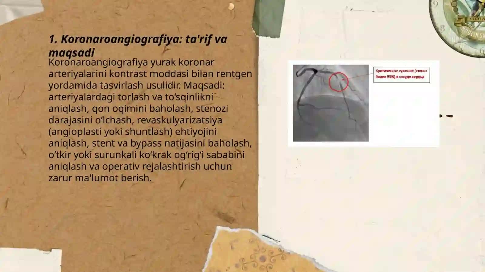 Koronaroangiografiya 3