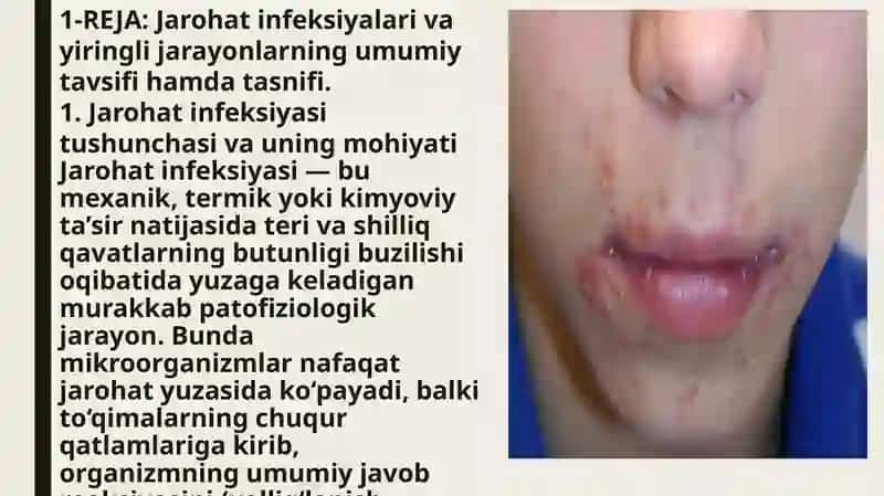 Yiringli-yalliglanish, jarohat yuqumli kasalliklarni keltirib chiqaruvchi mikroorganizmlar 3