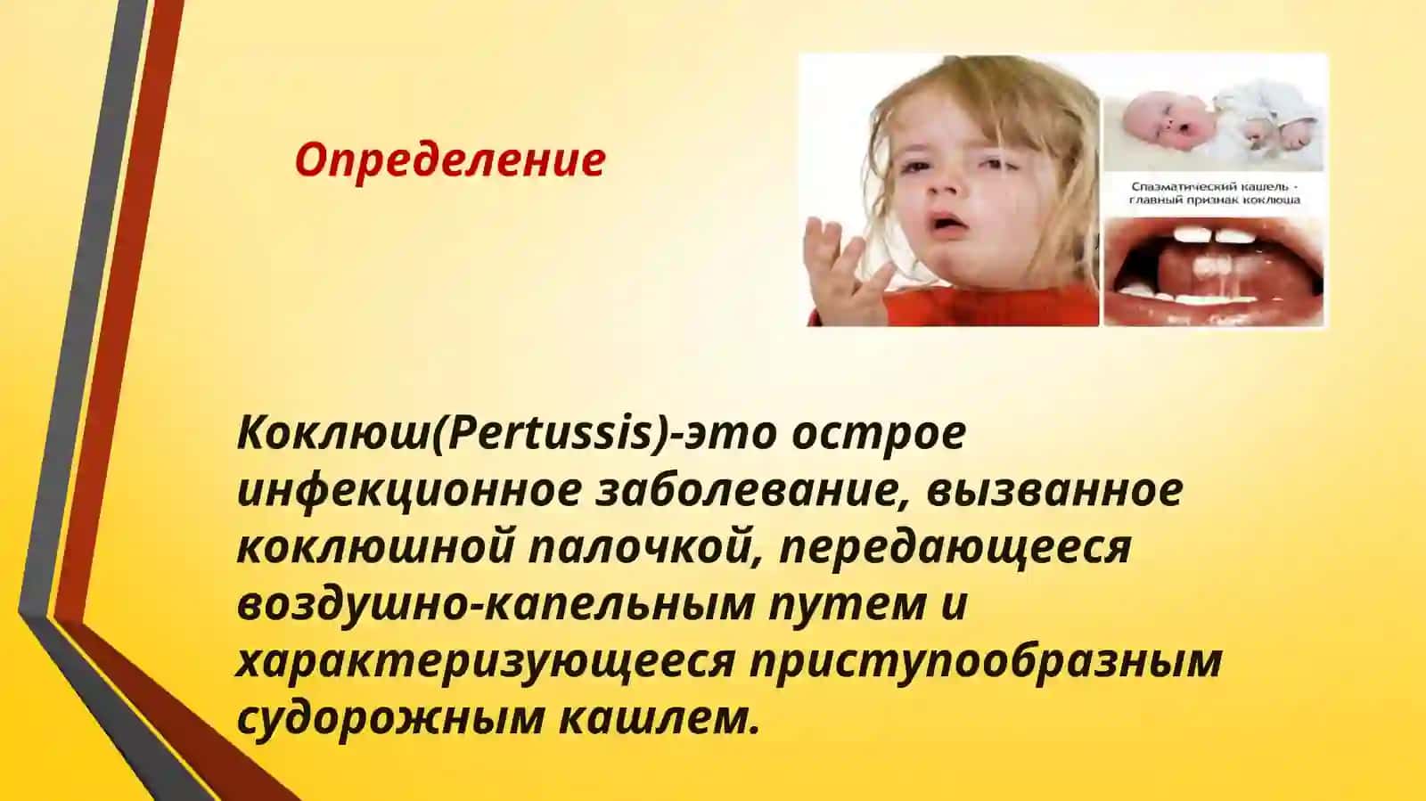 КОКЛЮШИ ПАРАКОКЛЮШ 3
