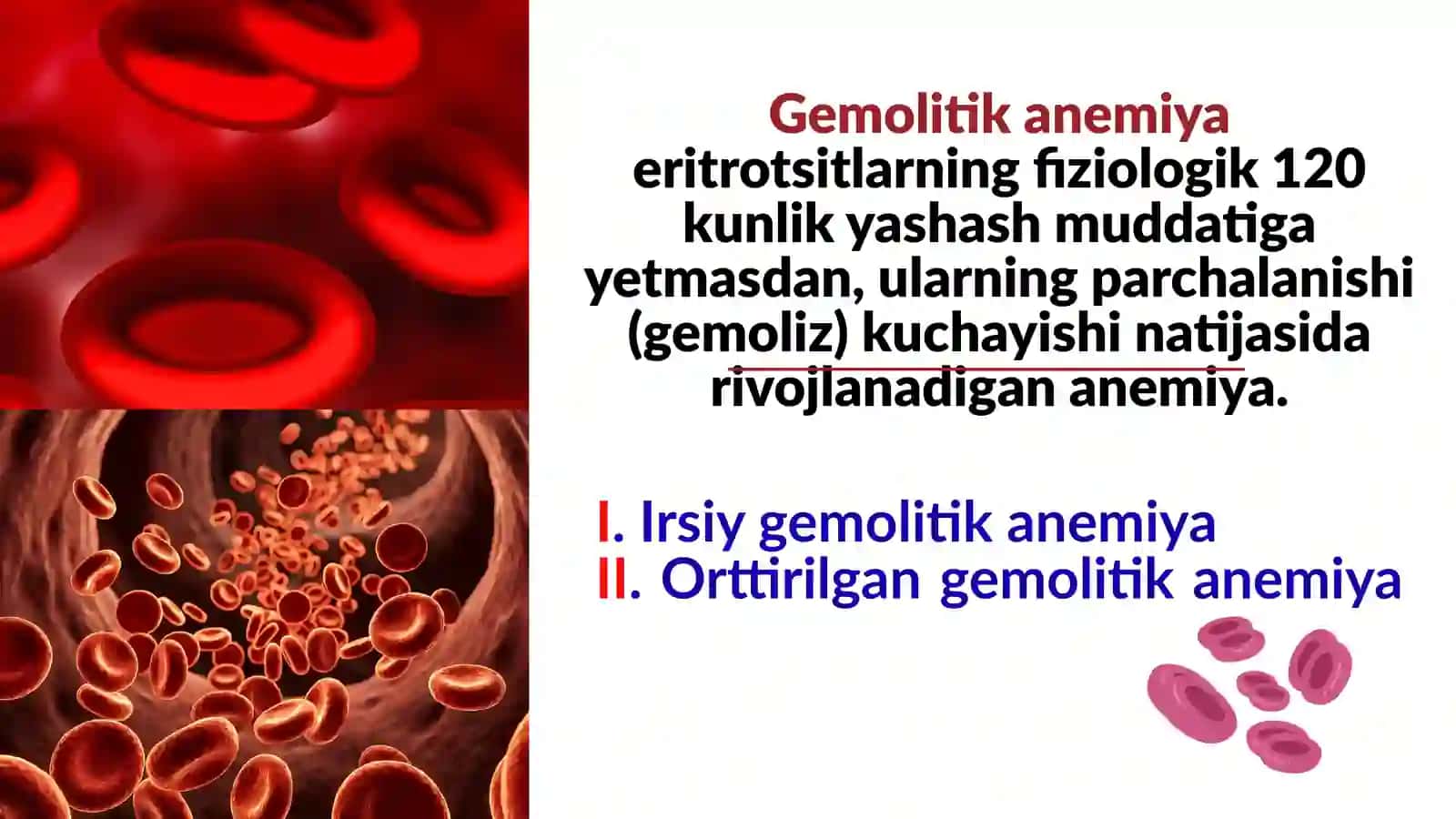 Gemolitik anemiya 3