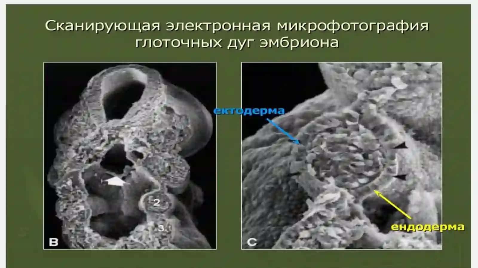 Хазмтизими:Юз-жағ ва оғиз бўшлиғи тараққиёти ва тузилиши 3