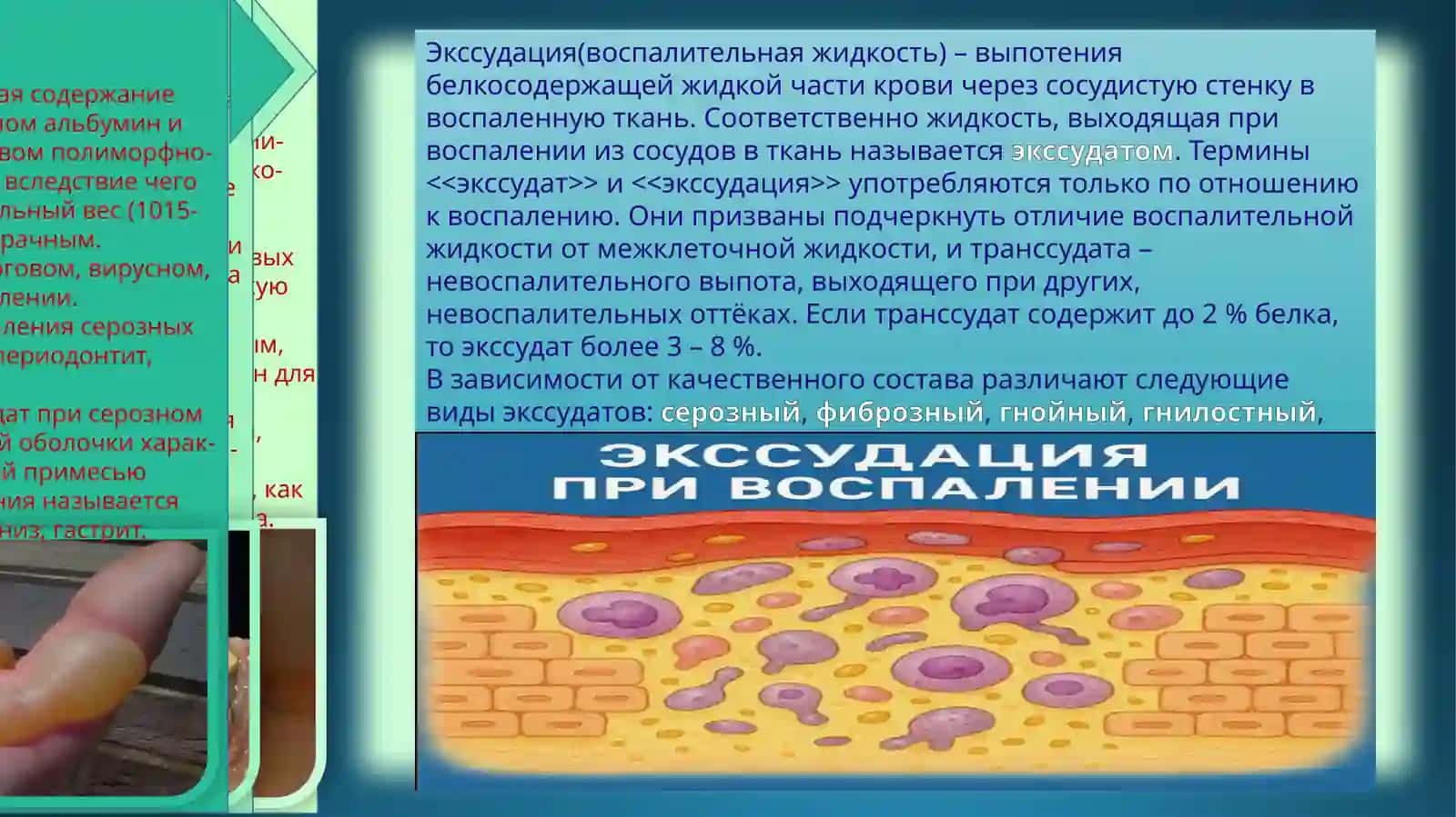 ПАТОФИЗИОЛОГИЯ 3