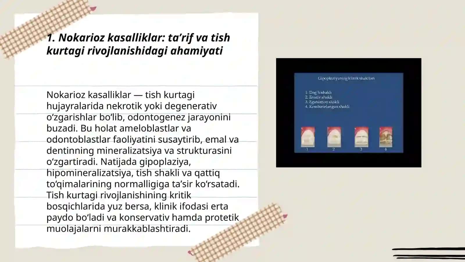 Tish chiqqunga qadar (tish kurtagi rivojlanish gistogenezida) tish qattiq toʼqimalarida paydo boʼladigan nokarioz kasalliklar 3