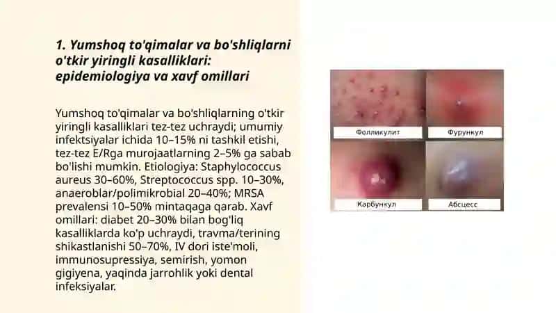 Yumshoq to'qimalar va bo'shliqlarni o'tkir yiringli kasalliklari 3