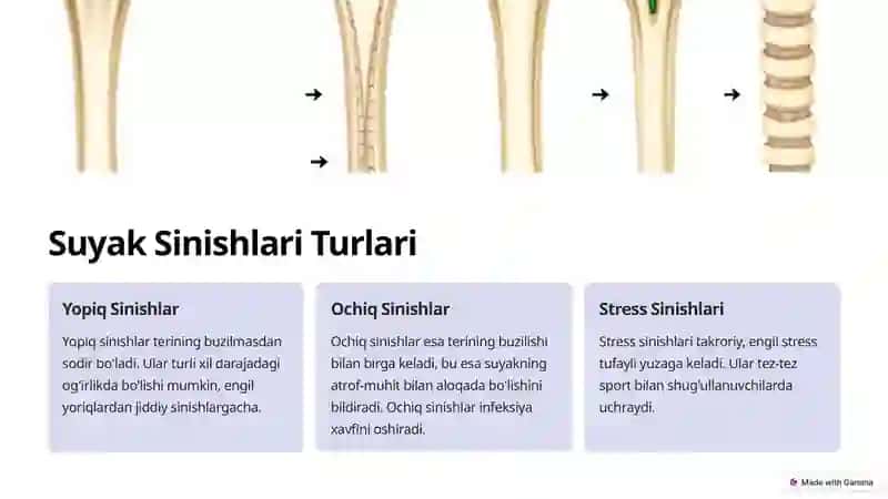 Suyak Sinishlarda Zamonaviy Davolash Usullari 3