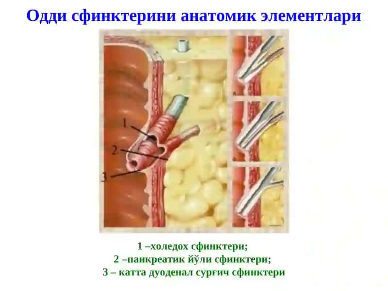 Механик сариқлик, постхолецистэктомик синдром 3
