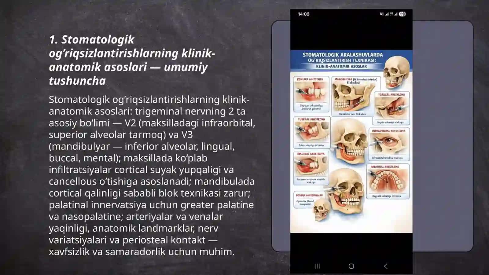Stomatologik aralashuvlarda og’riqsizlantirishlarni bajarish texnikasining klinik-anatomik asoslari 3