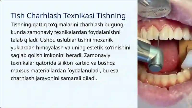 Tishlarning qattiq to‘qimalarini charхlash usuli (tехnikasi). Tishlarni charхlash paytida ishlatiladigan asboblar, olmos va boshqa charхlash vositalari to‘plami 3