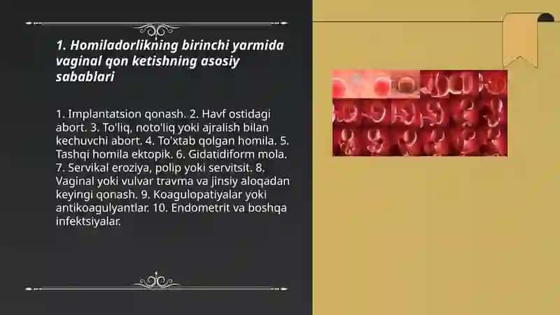 Homiladorlikda qon ketishi 3