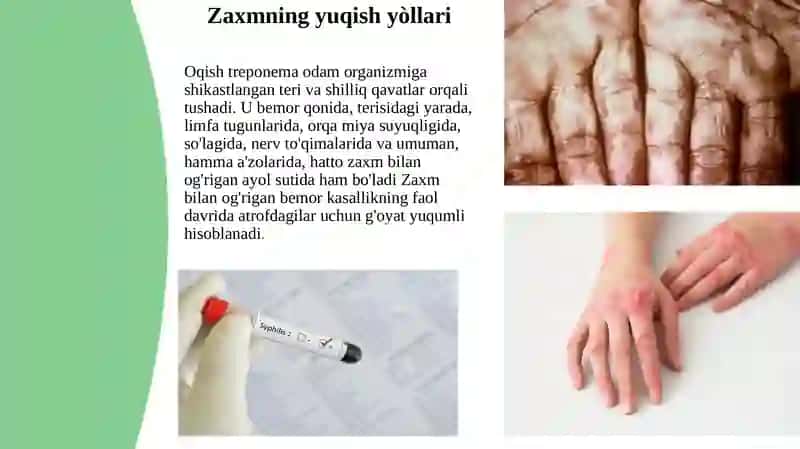 ZAXM 3
