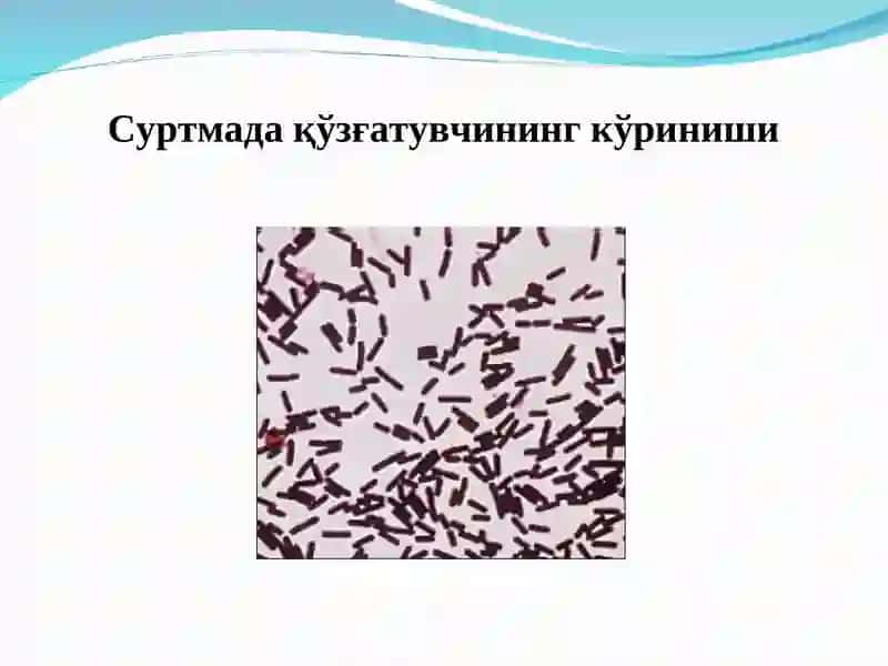 Брадзот ваунгақарши кураш тадбирлари 3