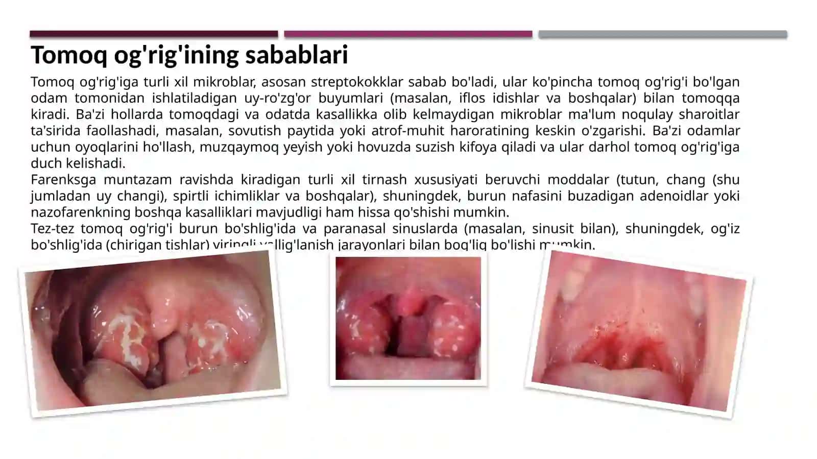 Angina va uning asoratlari 3