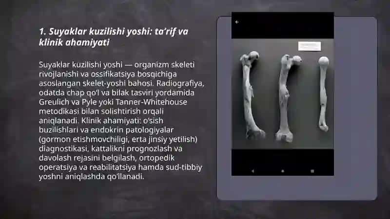 Suyaklar kuzlshi yasi va uzun naysimon suyaklar 3