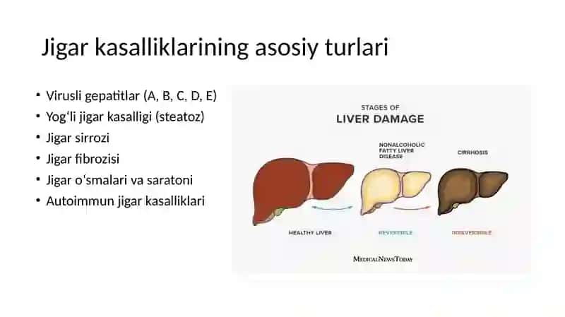Jigar kasalliklari pptx 3