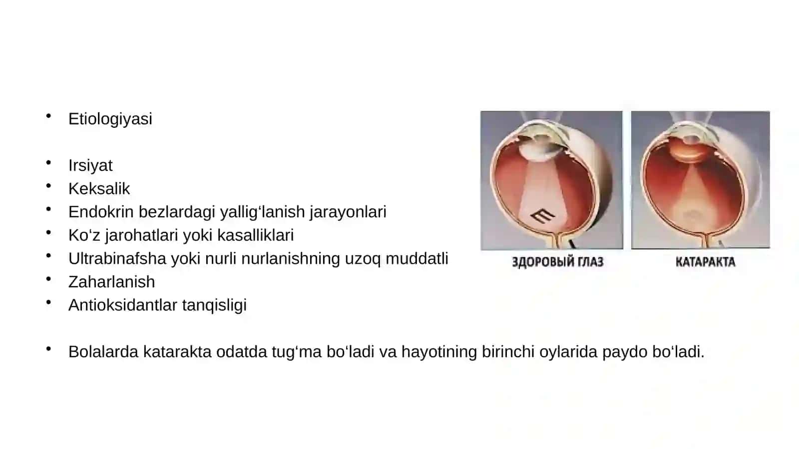 KATARAKTALAR 3