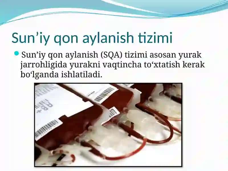 Sun’iy qon aylanish,sun’iy o’pka gemodializ apparatlari 3