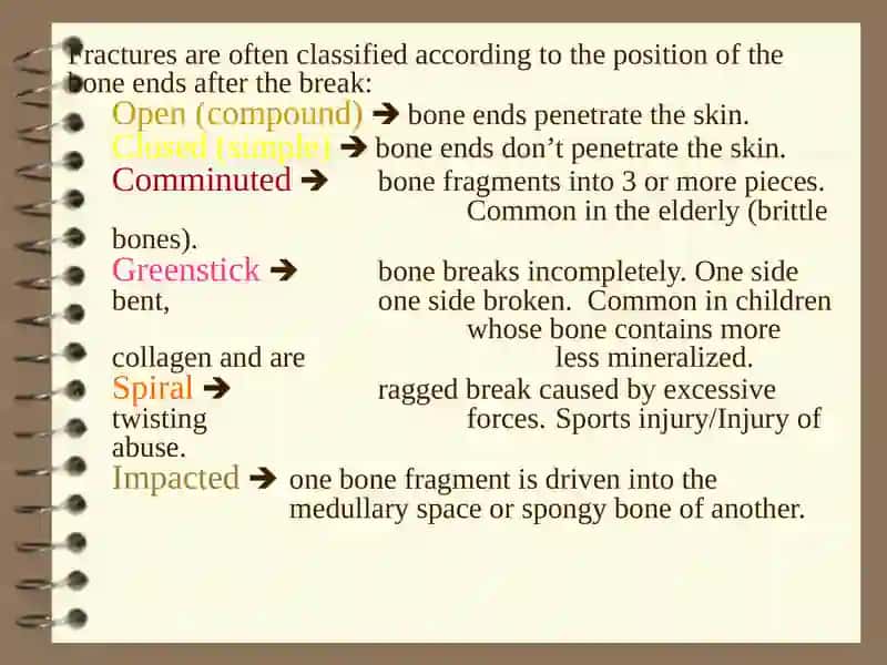 FRACTURES 3