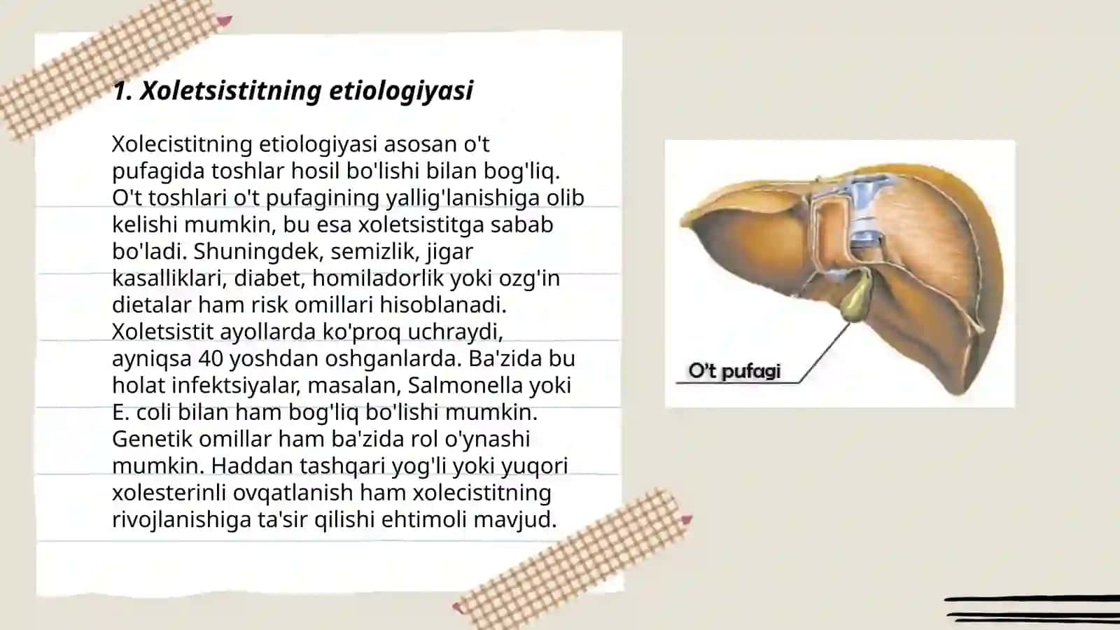 Xoletsistitning etiologiyasi 3